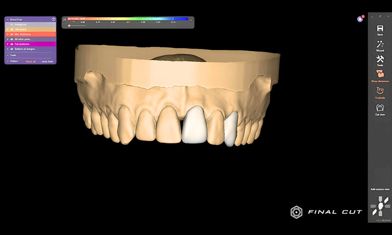 TruSmile Module - FinalCut™