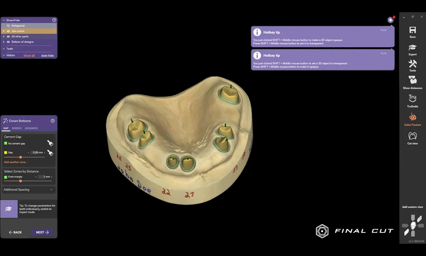 Exocad Software - FinalCut™