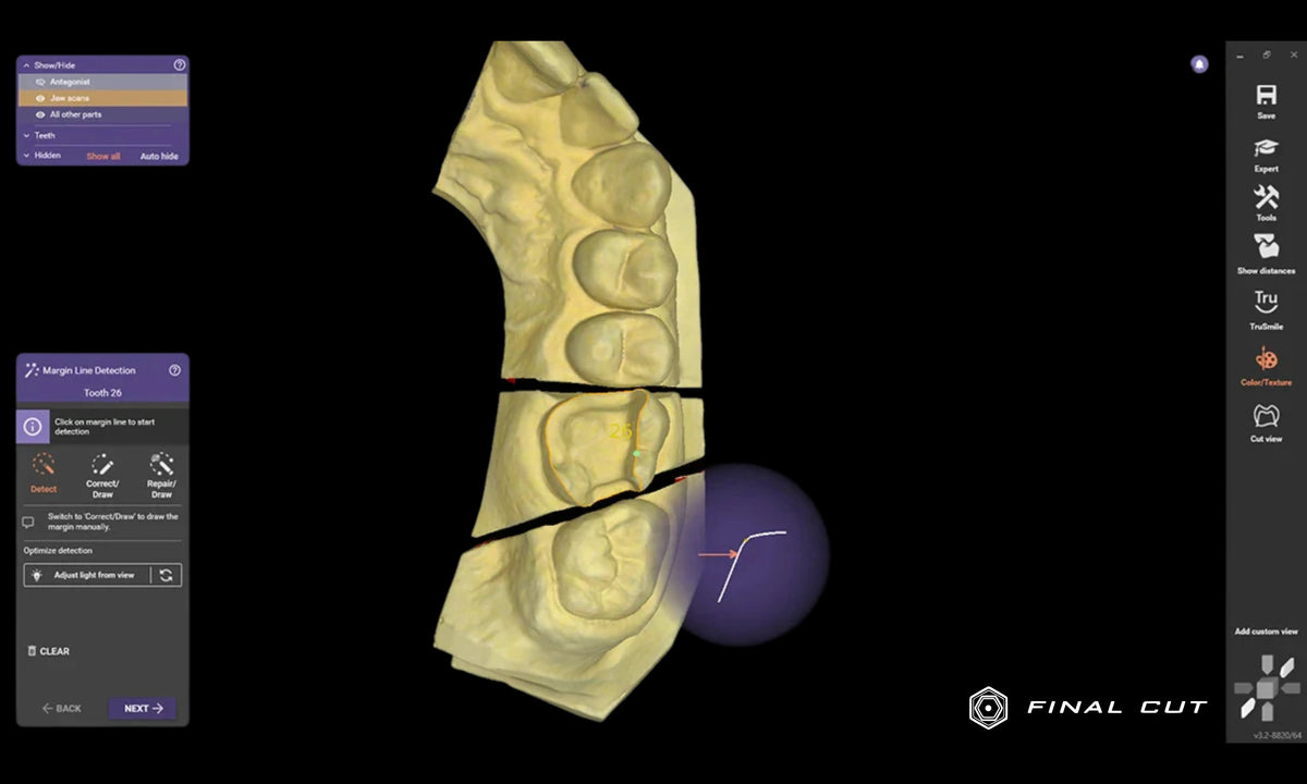 Exocad File Exocad Software – FinalCut™ Dental Milling Center