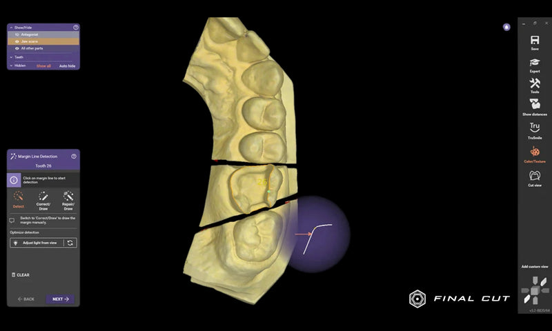 Exocad Software - FinalCut™