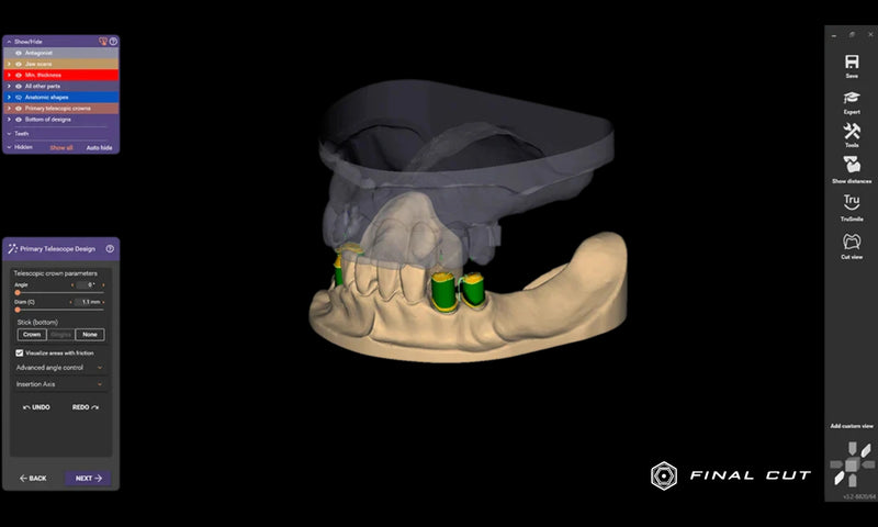 Exocad Software - FinalCut™