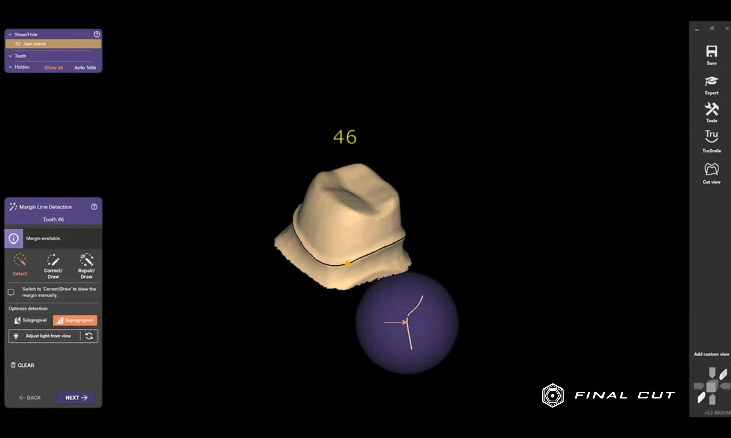 Exocad Software - FinalCut™