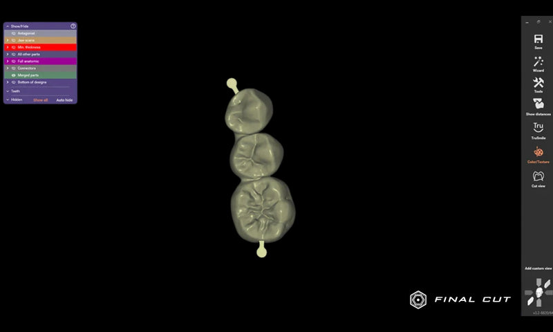 Exocad Software - FinalCut™