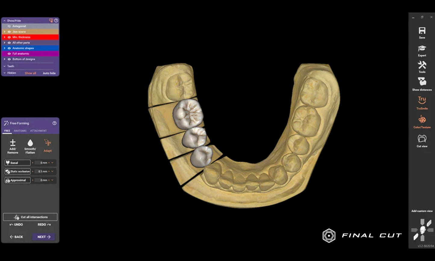 Exocad Software - FinalCut™