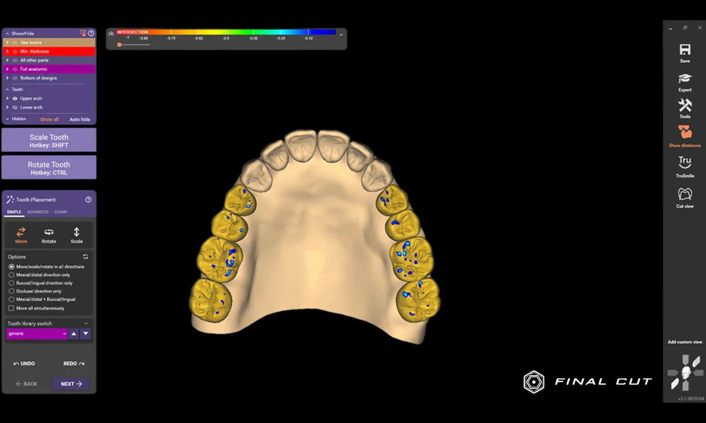 Exocad Software - FinalCut™