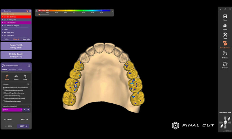 Exocad Software - FinalCut™