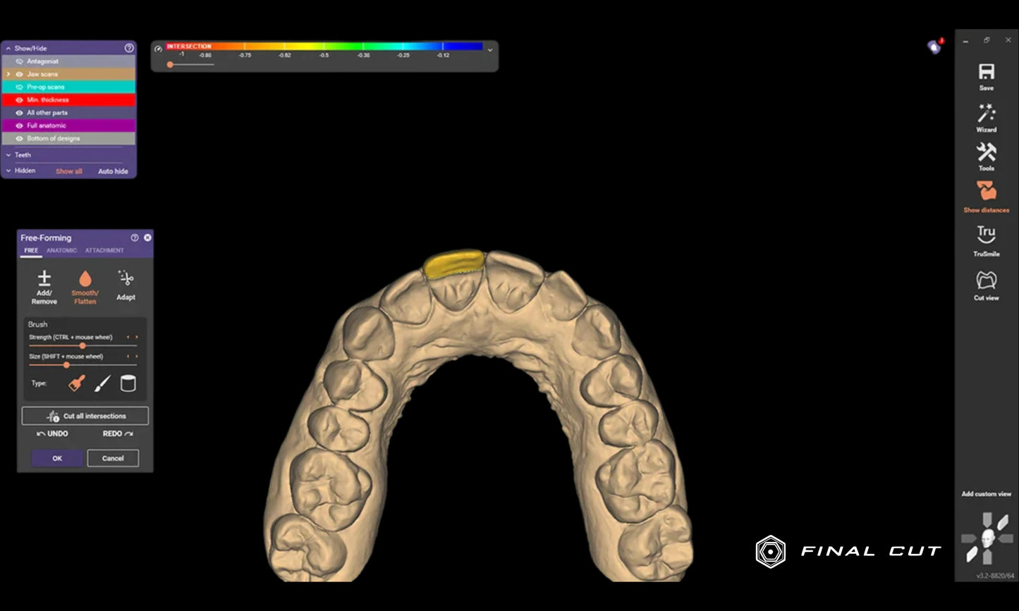 Exocad Software - FinalCut™