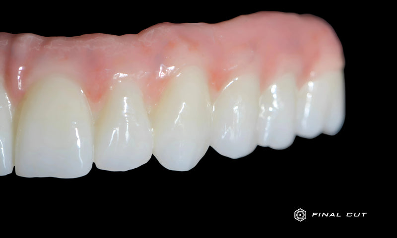 Full Arch with Pink Porcelain