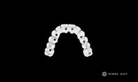 Zirconia Hybrid Full Arch - Milling Service - FinalCut™