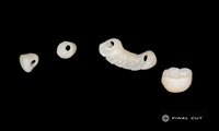 Zirconia Implant Crown & Bridge - Design & Milling Service - FinalCut™