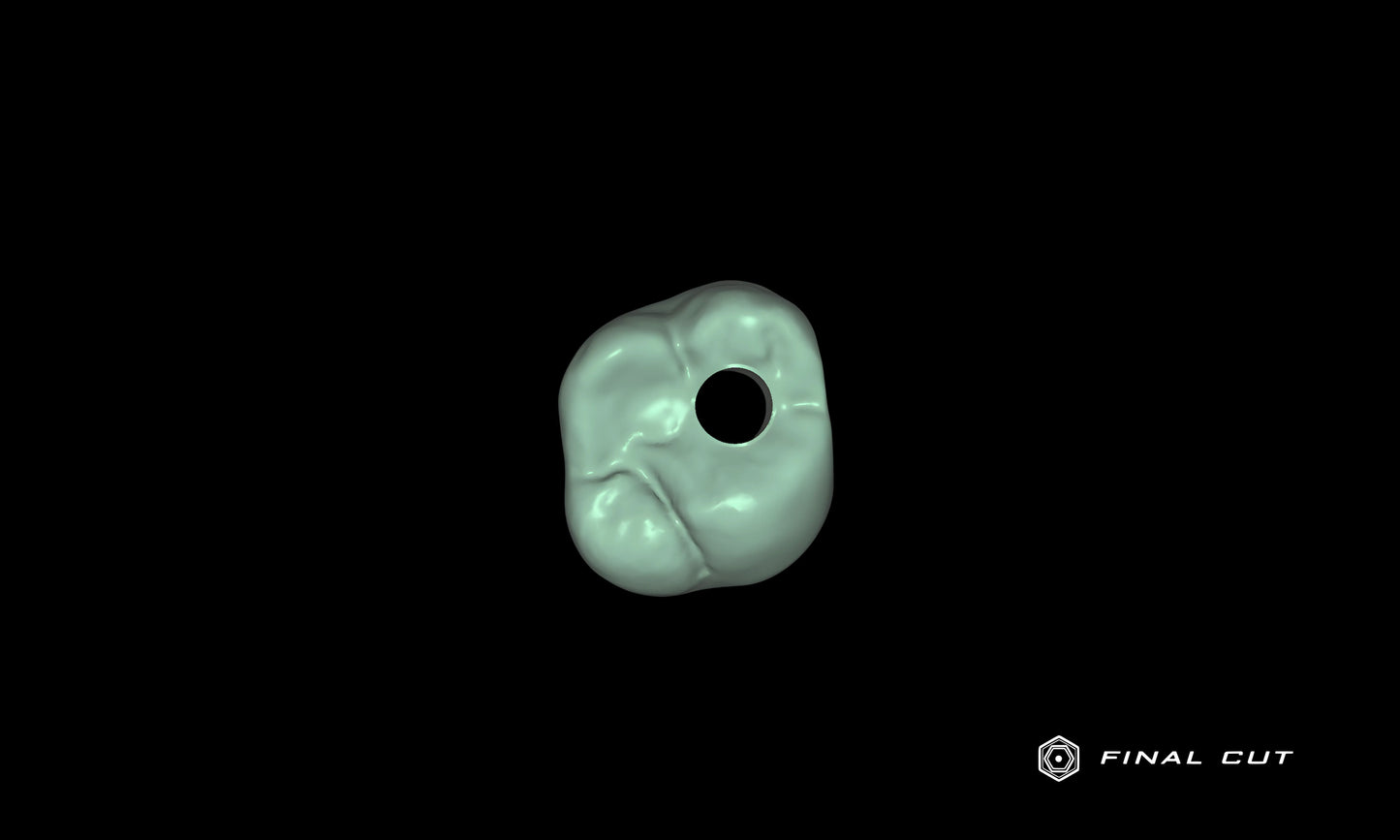 PMMA Implant Crown & Bridge - Design Service - FinalCut™