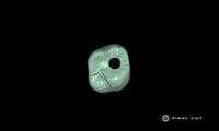 PMMA Implant Crown & Bridge - Design Service - FinalCut™