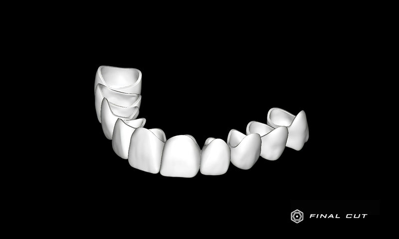 PMMA Crown & Bridge - Milling Service - FinalCut™