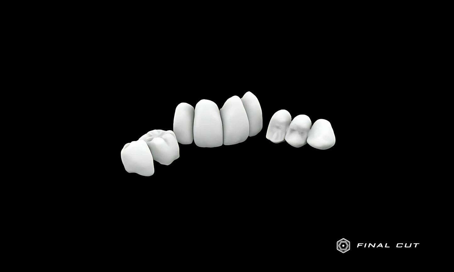 PMMA Crown & Bridge - Design & Milling Service - FinalCut™