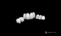 PMMA Crown & Bridge - Design & Milling Service - FinalCut™