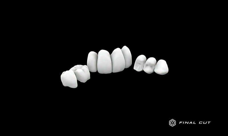 PMMA Crown & Bridge - Design & Milling Service - FinalCut™