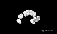 PMMA Crown & Bridge - Milling Service - FinalCut™