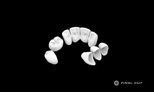 PMMA Crown & Bridge - Milling Service - FinalCut™