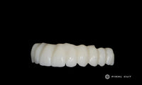 PMMA Hybrid Full Arch - Milling Service - FinalCut™