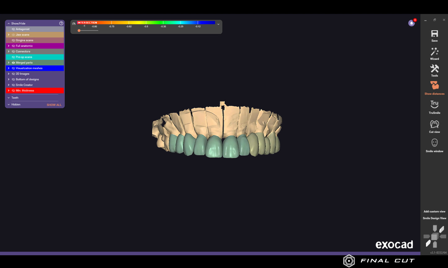 PMMA Crown & Bridge - Design & Milling Service - FinalCut™