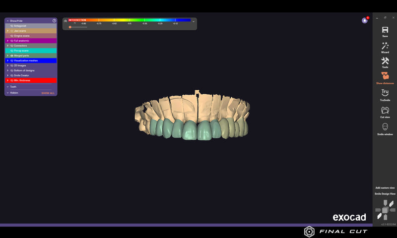 PMMA Crown & Bridge - Design & Milling Service - FinalCut™