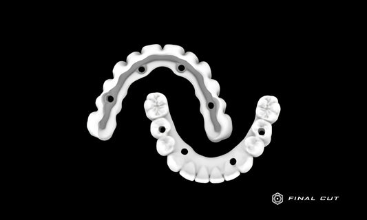 PMMA Full Arch over Bar - Design & Milling Service - FinalCut™