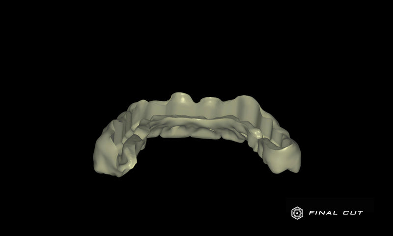 PMMA Full Arch over Bar - Design & Milling Service - FinalCut™
