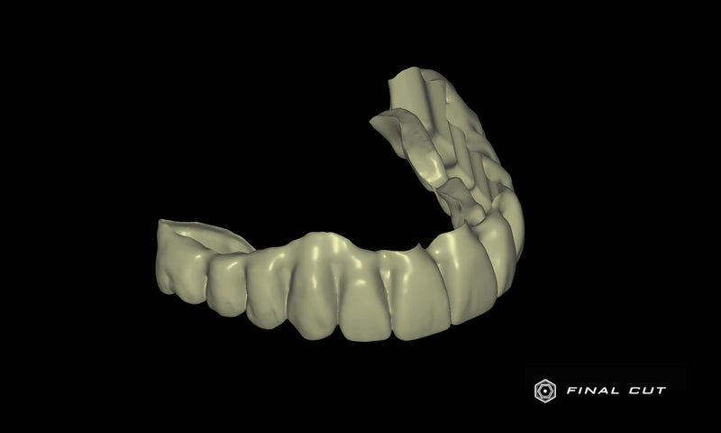 PMMA Full Arch over Bar - Design & Milling Service - FinalCut™
