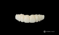 PMMA Full Arch over Bar - Design & Milling Service - FinalCut™