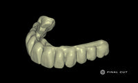 PMMA Full Arch over Bar - Design Service - FinalCut™