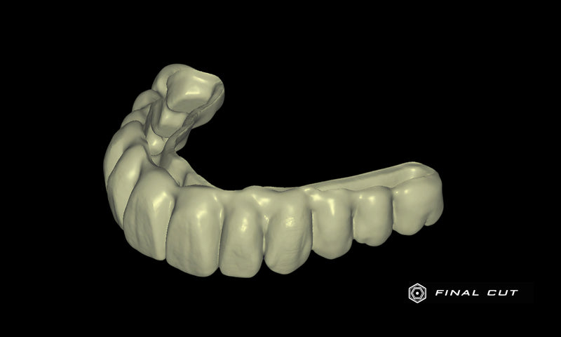 PMMA Full Arch over Bar - Design Service - FinalCut™