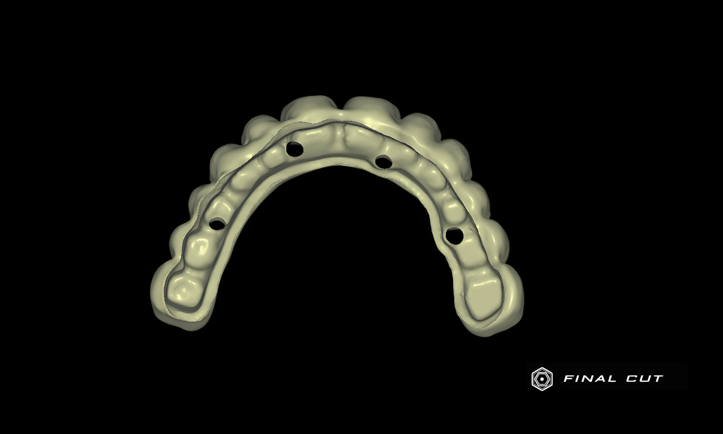 PMMA Full Arch over Bar - Design Service - FinalCut™