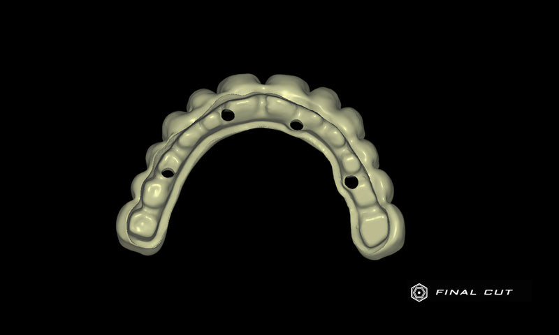 PMMA Full Arch over Bar - Design Service - FinalCut™