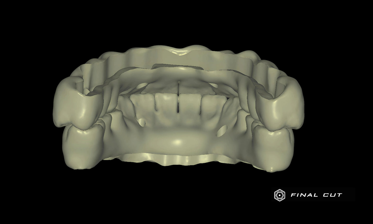 PMMA Full Arch over Bar - Design Service - FinalCut™