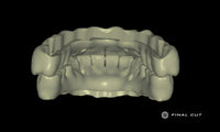PMMA Full Arch over Bar - Design Service - FinalCut™