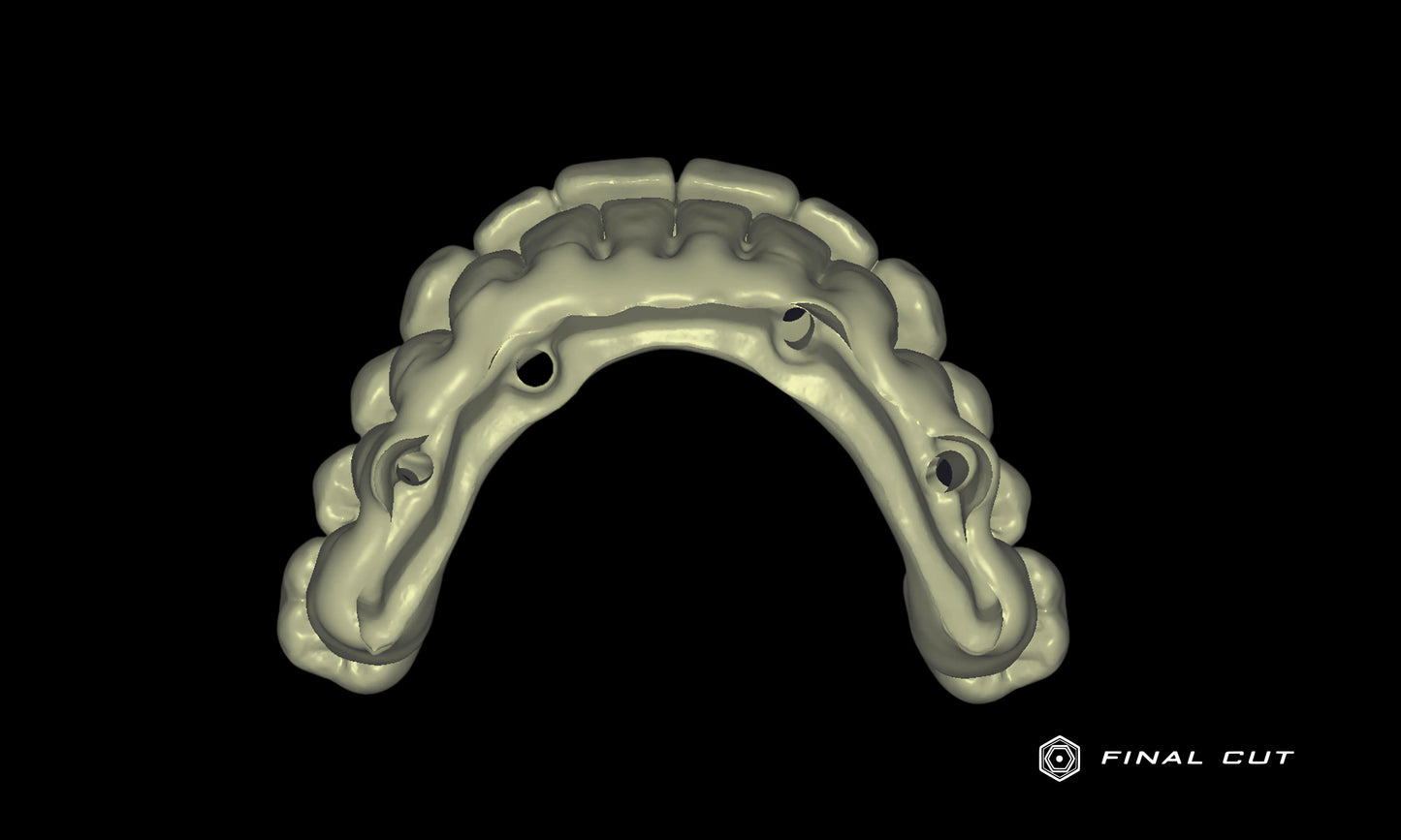 PMMA Full Arch over Bar - Design Service - FinalCut™