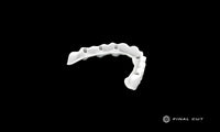 Titanium Custom Abutment - Design Service - FinalCut™