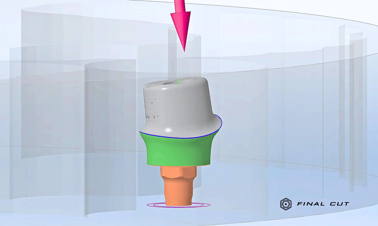 Titanium Custom Abutment - Milling Service - FinalCut™