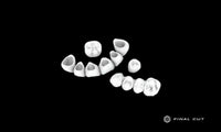 Zirconia Crown & Bridge - Design & Milling Service - FinalCut™