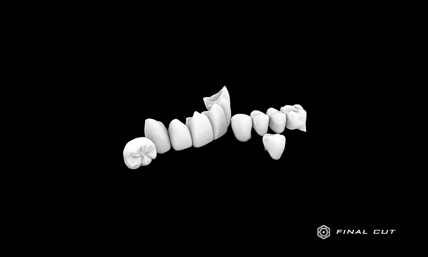 Zirconia Crown & Bridge - Milling Service - FinalCut™