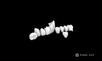 Zirconia Crown & Bridge - Milling Service - FinalCut™