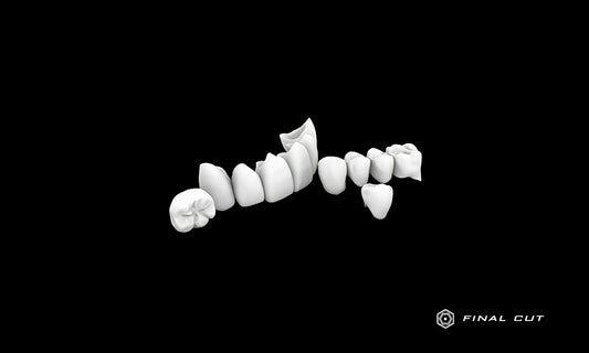 Zirconia Crown & Bridge - Milling Service - FinalCut™