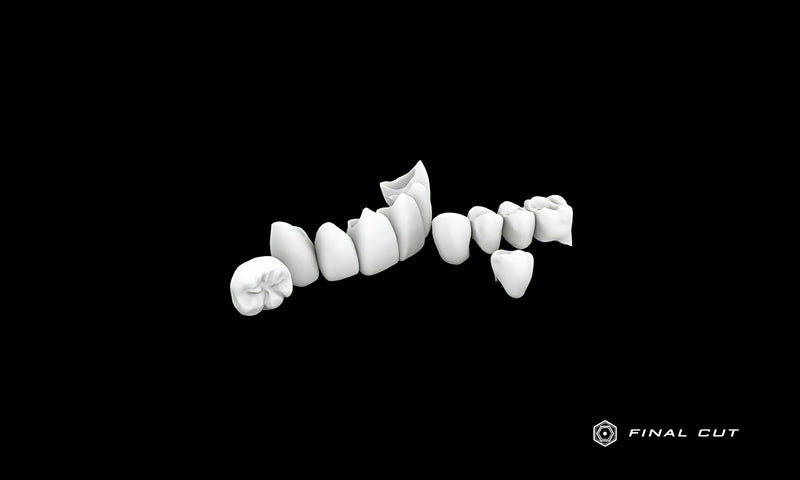 Zirconia Crown & Bridge - Milling Service - FinalCut™