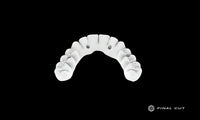 Zirconia Full Arch Over Bar - Design Service - FinalCut™