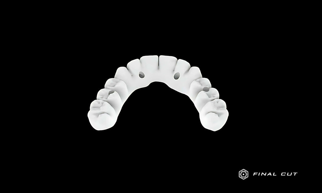 Zirconia Full Arch Over Bar - Design Service