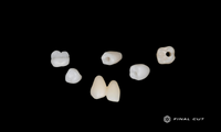 Zirconia Crown & Bridge - Milling Service - FinalCut™