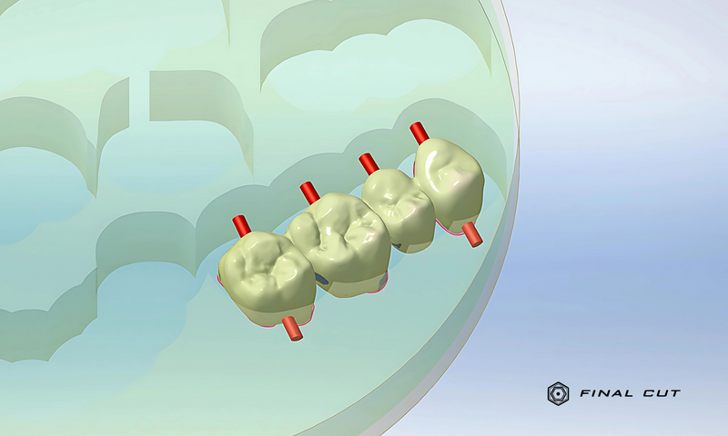 Zirconia Crown & Bridge - Milling Service - FinalCut™