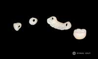 Zirconia Implant Crown & Bridge - Milling Service - FinalCut™