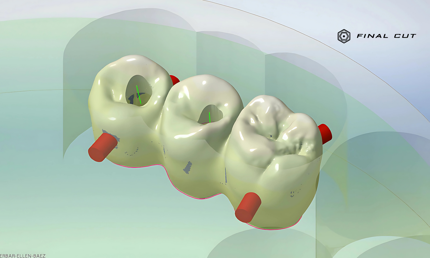 Zirconia Implant Crown & Bridge - Milling Service - FinalCut™