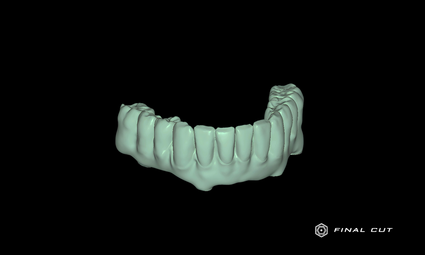 Zirconia Hybrid Full Arch - Design Service - FinalCut™